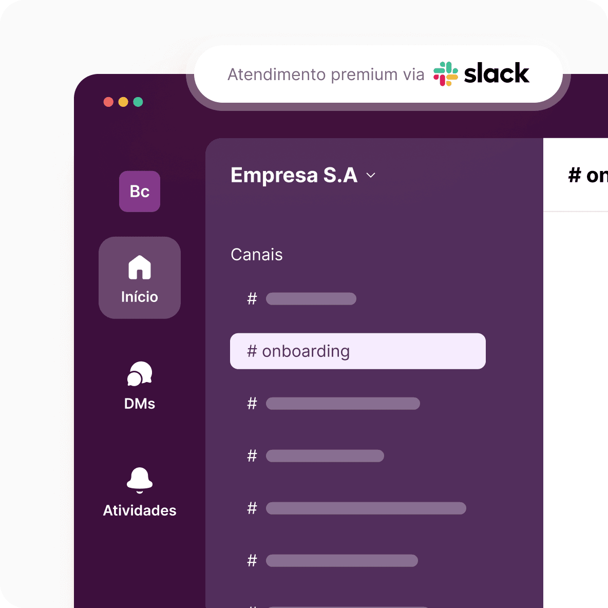Resultados operacionais com Suporte RD